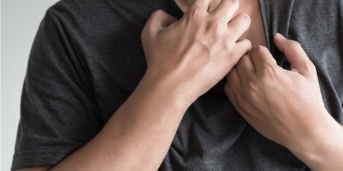 Eczema Treatment: Medical And Natural Solutions That Help Manage Atopic Dermatitis